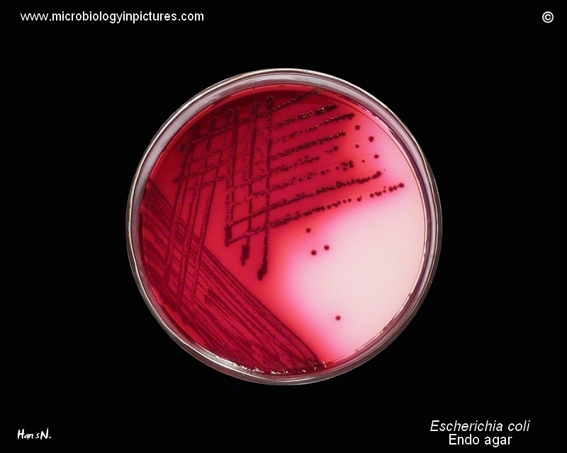E.coli, lactose positive
