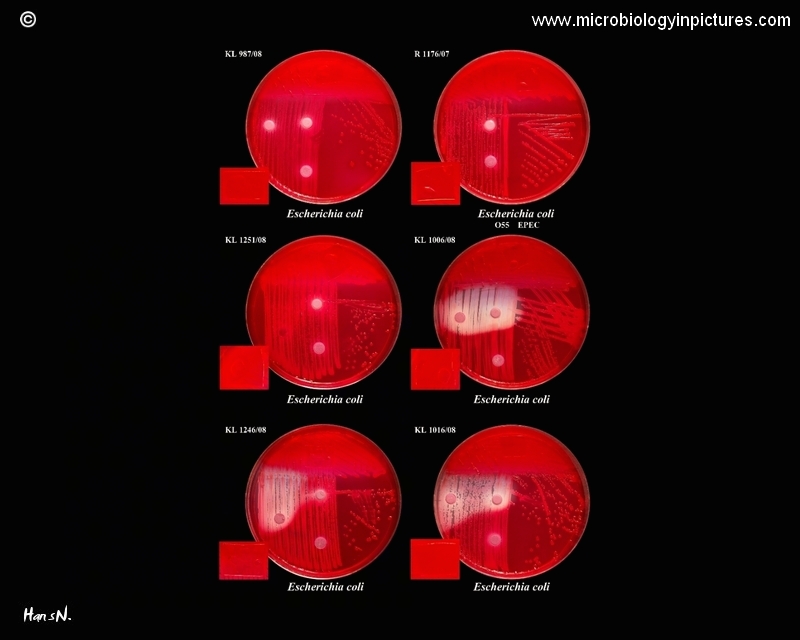 6 strains of E.coli