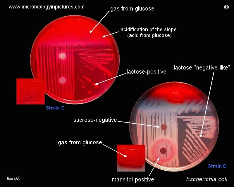 delayed lactose fementation
