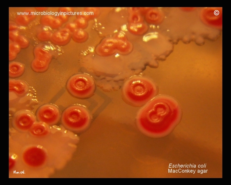 E.coli, Proteus sp.