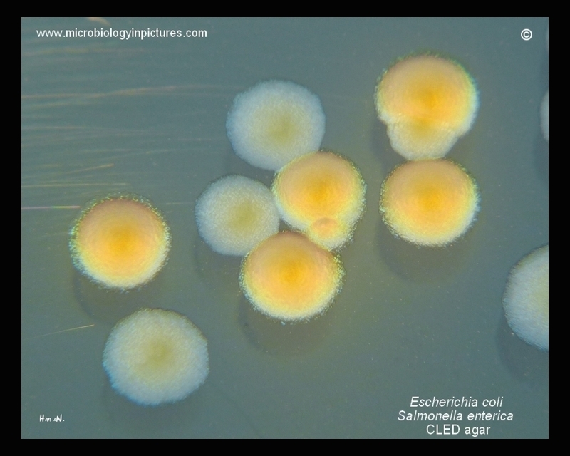 enteric bacteria on CLED agar