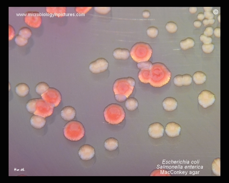 E.coli, S.enterica