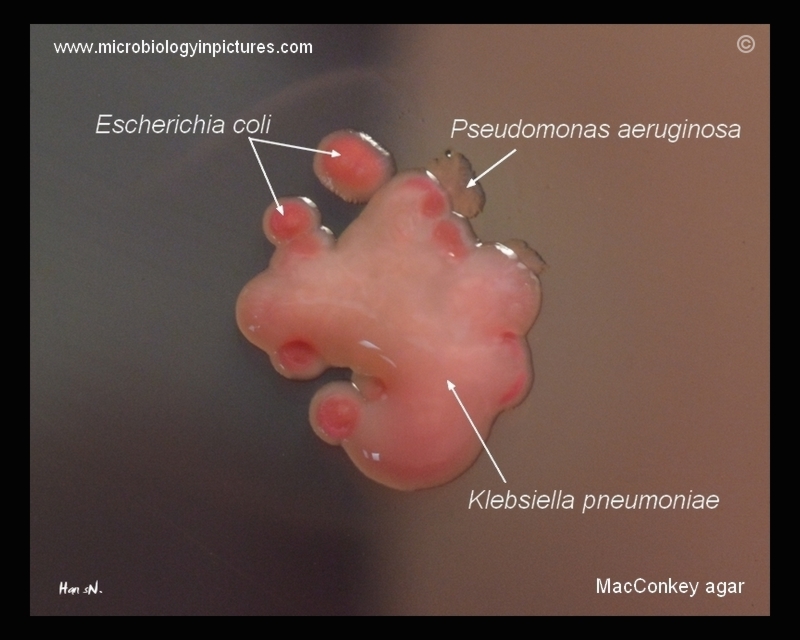 Klebsiella, E.coli, P.eruginosa