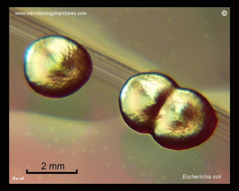 lactose fermenting colonies