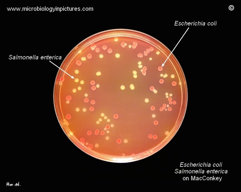 E.coli on agar