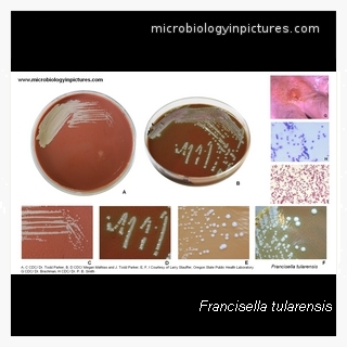 francisella
