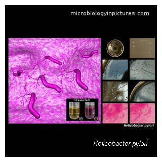 helicobacter pylori