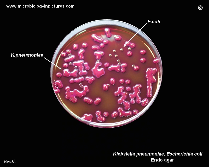 Klebsiella pneumoniae, E.coli colony appearance on Endo