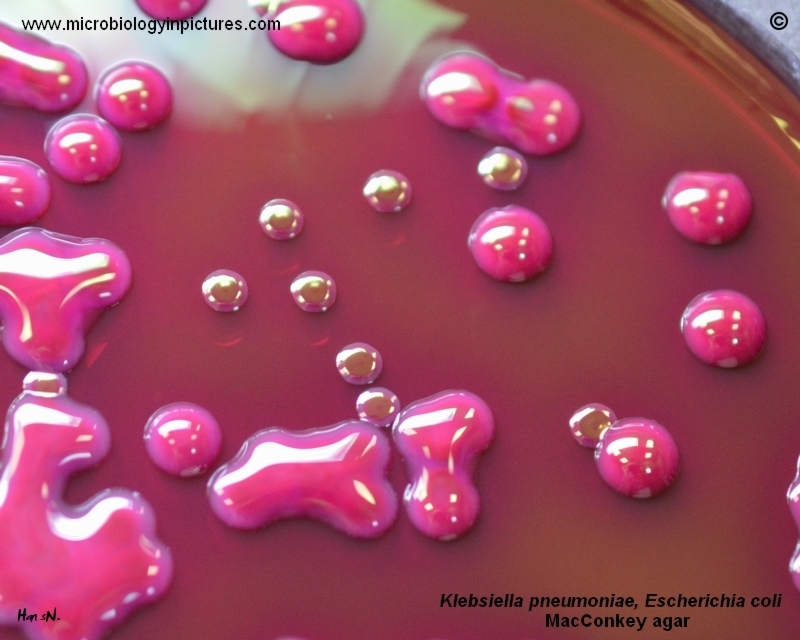 Klebsiella pneumoniae, E.coli colonies on Endo