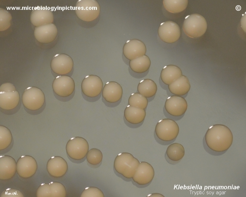 Klebsiella pneumoniae growth on TSA