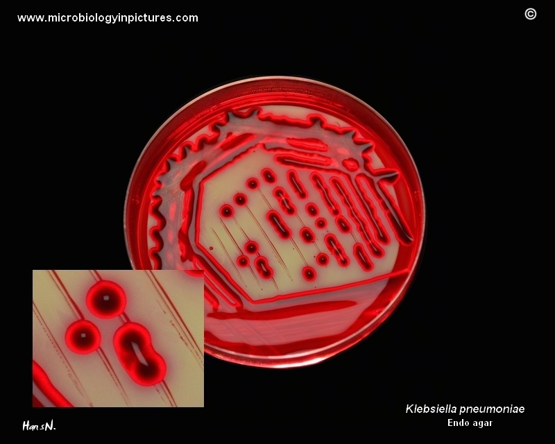 Klebsiella pneumoniae, pure culture, isolated colonies on Endo