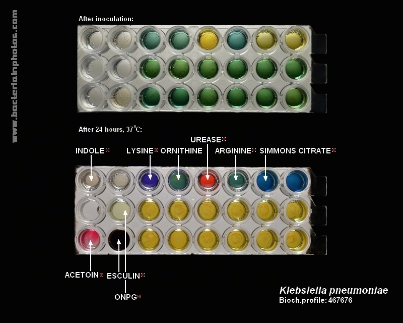 a kit for K.pneumoniae identification with, tests for identification of enteric bacteria