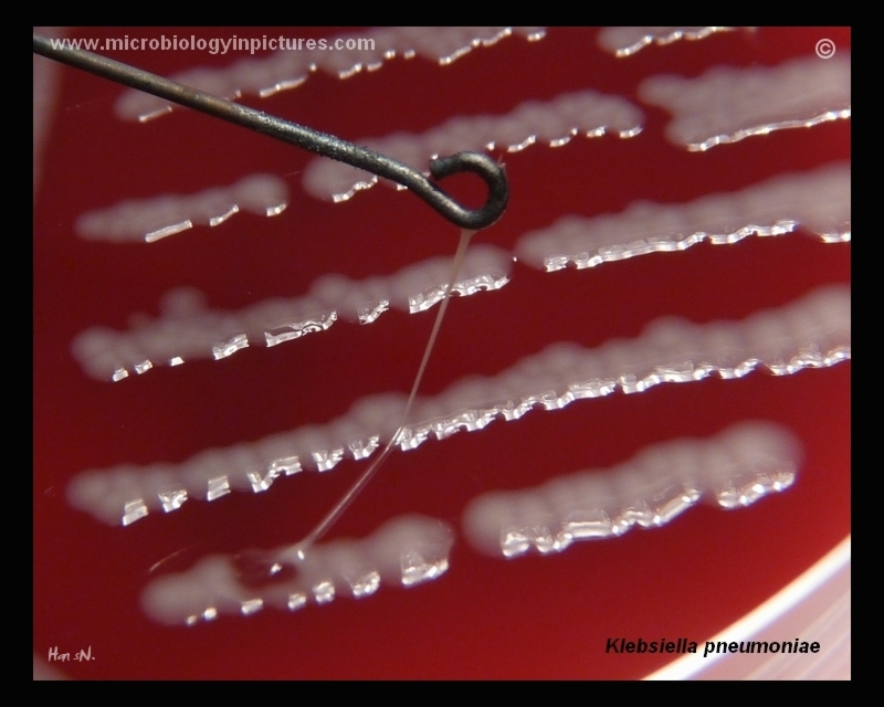 K.pneumoniae colonies