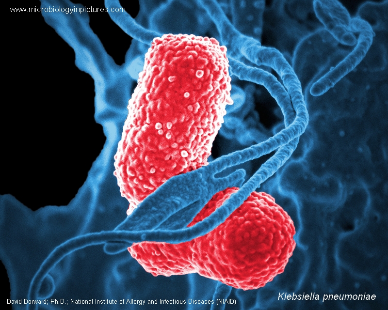 klebsiella pneumoniae scanning electron micrograph, sem