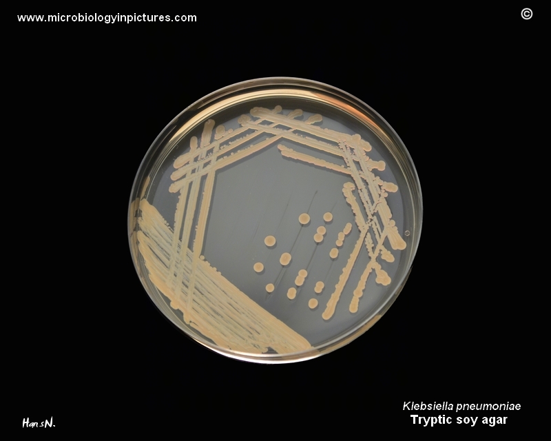 Klebsiella pneumoniae, TSA
