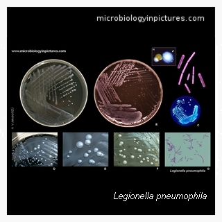 legionella