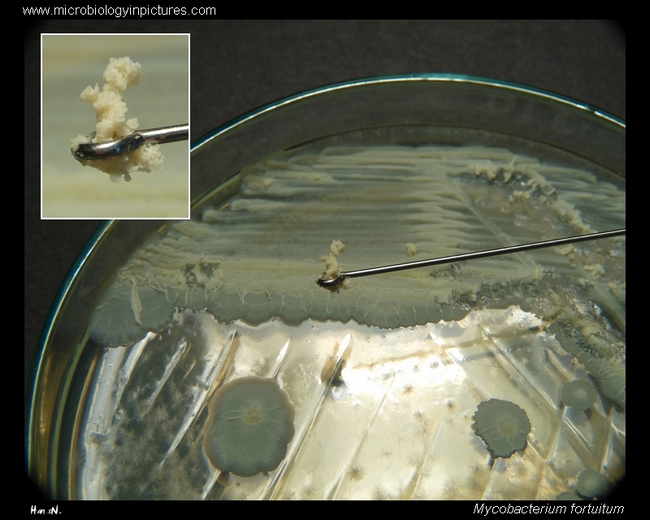 mycobacterium fortuitum colony consistence