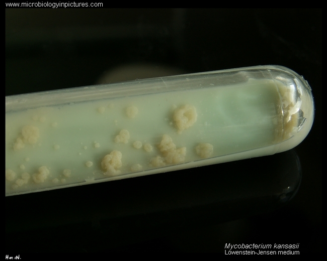 mycobacterium kansasii colonies on L-J medium