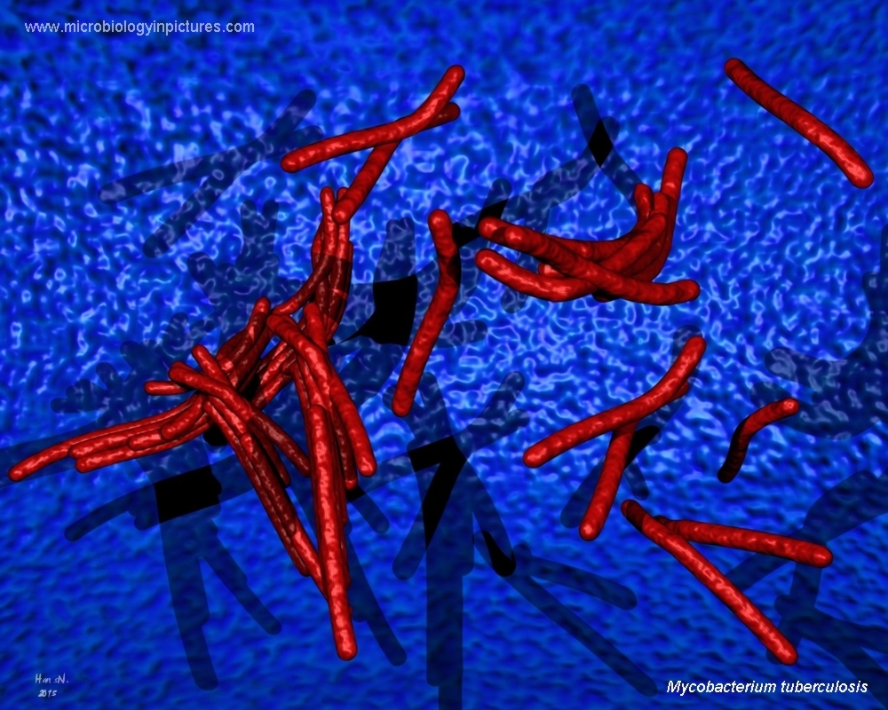 acid-fast stain image