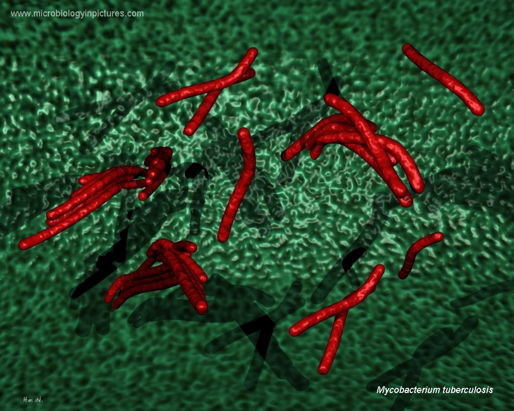 acid-fast bacteria, Ziehl-Neelsen stain