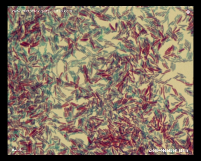 acid-fast bacteria, micrograph
