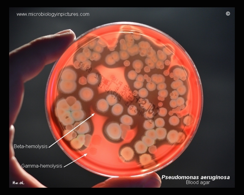 P.eruginosa hemolysis on blood agar