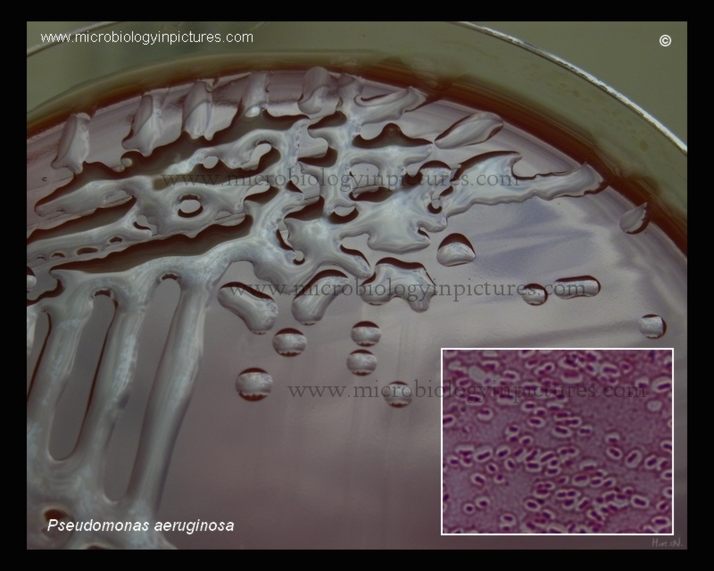 mucoid encapsulated P.aeruginosa