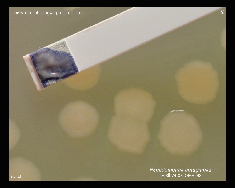 result of oxidase test with P.aeruginosa