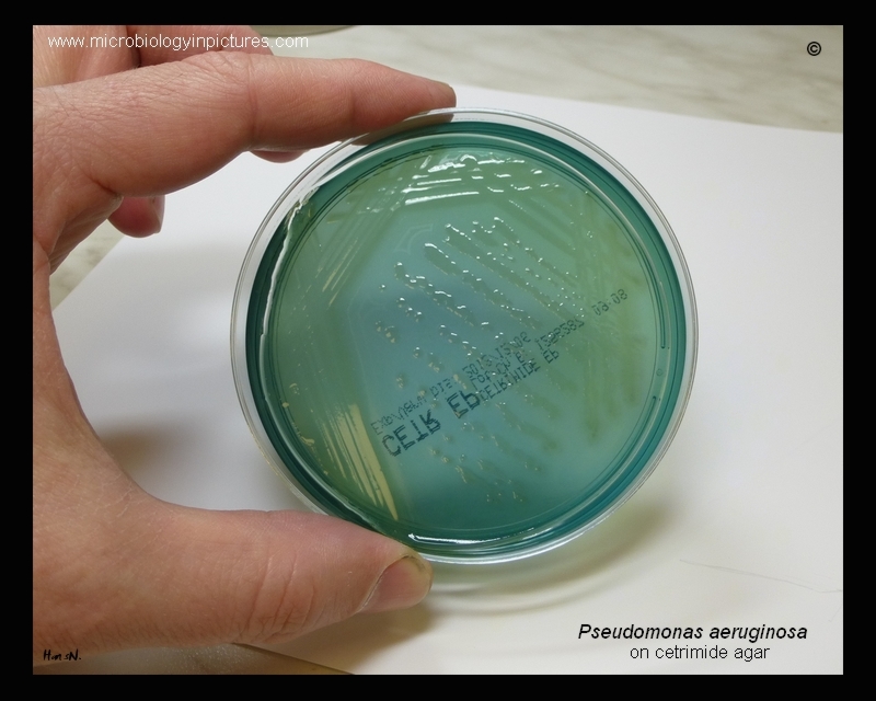 pigments production of P.aeruginosa