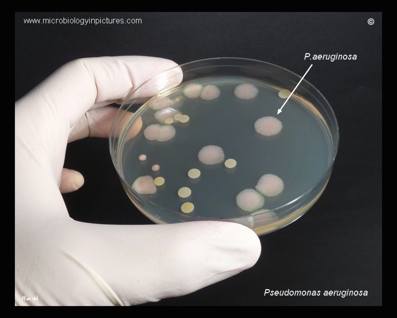 bacterial colonies in Petri dish