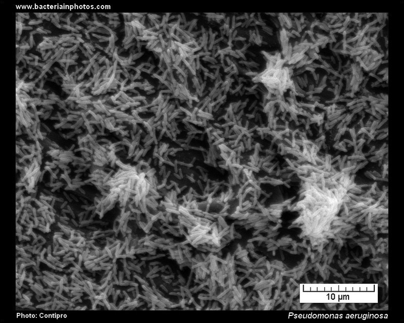 bacterial biofilm