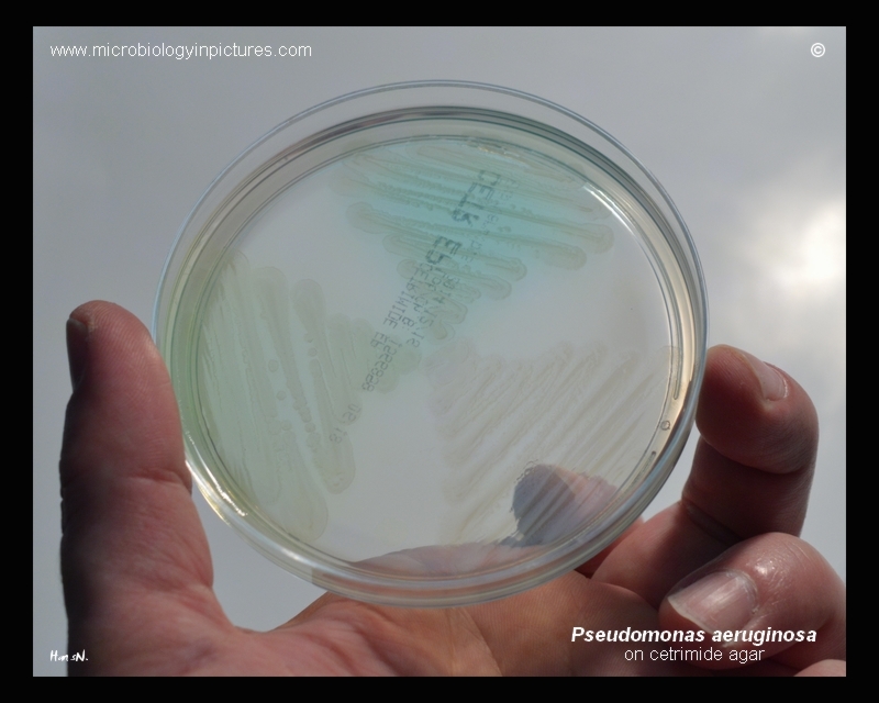 different production of pigment by P.aeruginosa