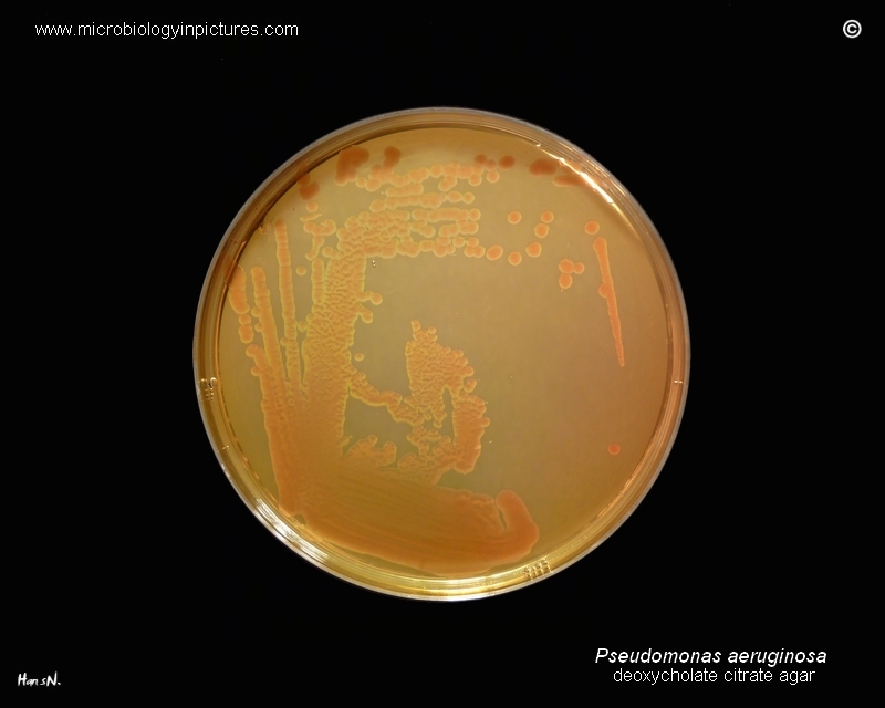CLED agar, lac- colonies