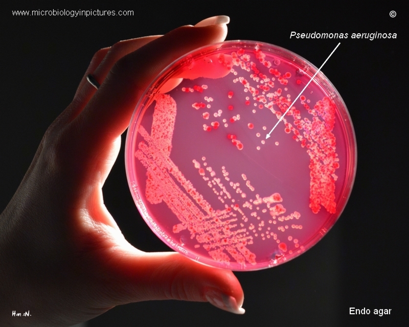 bacteria in Petri dish