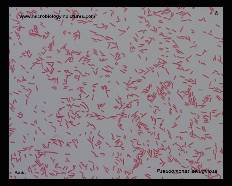 Pseudomonas aeruginosa micrograph
