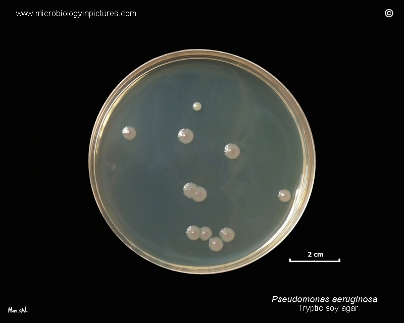P.aeruginosa character of growth on tsa