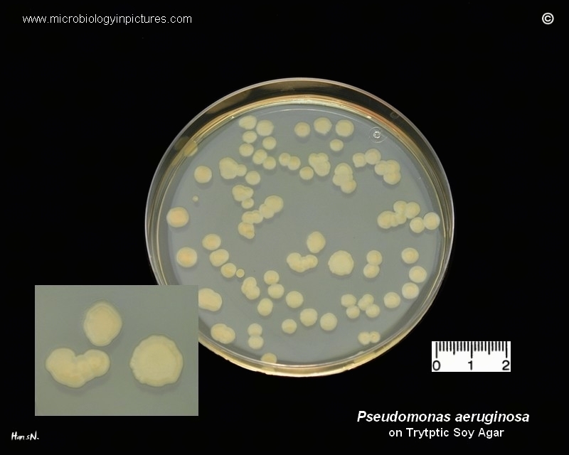 P.aeruginosa character of growth on tsa
