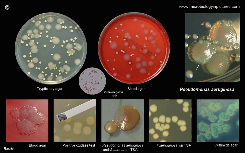 p.aeruginosa images