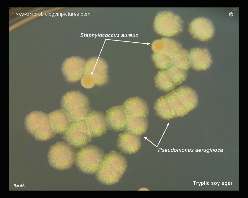 P.aeruginosa yellow-green colonies