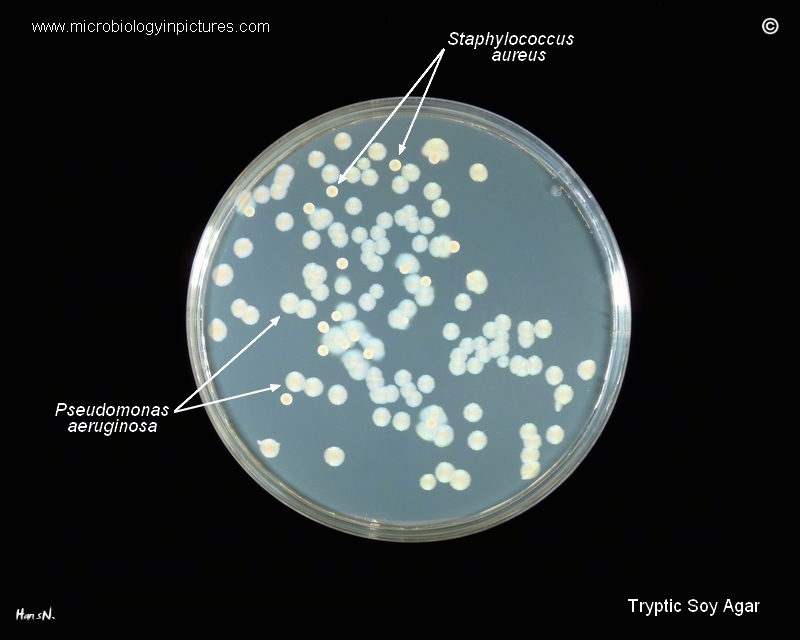 P.aeruginosa colony formation on tsa