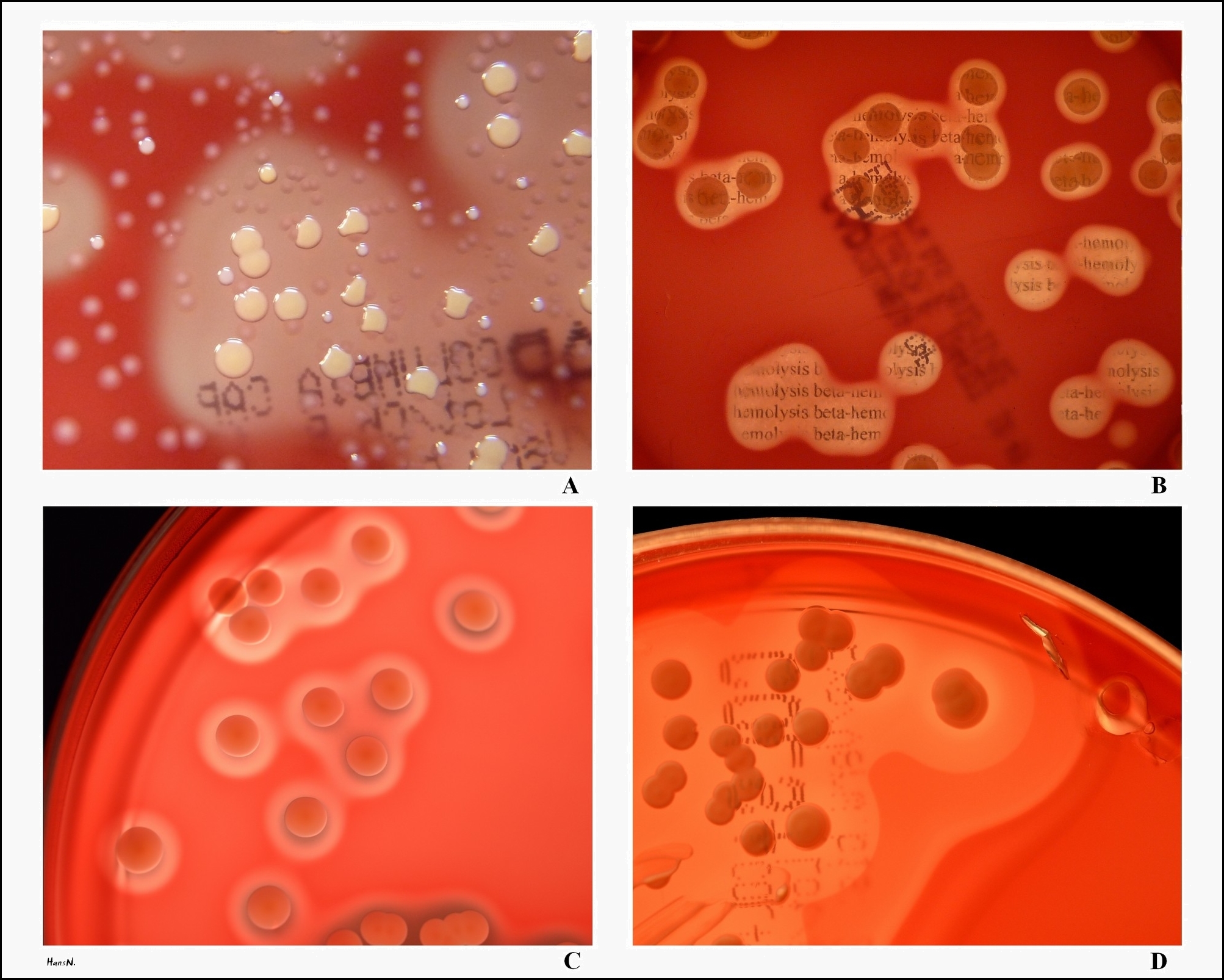 s.aureus types of hemolysis