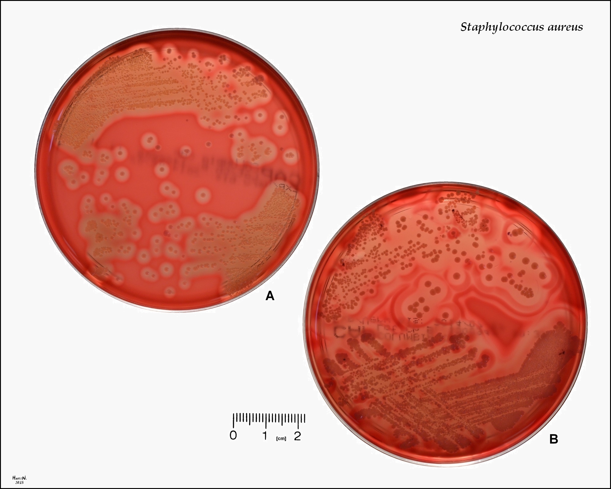 s. aureus in a Petri dish with blood agar, production of various hemolysins