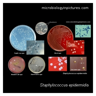 s.epidermidis