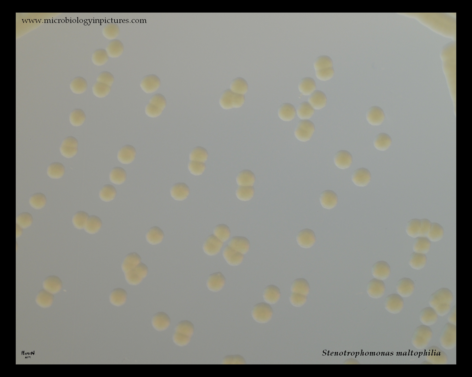 colonies of stenotrophomonas maltophilia on agar