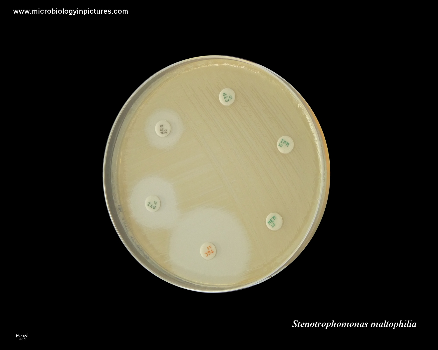 stenotrophomonas maltophilia carbapenems resistance