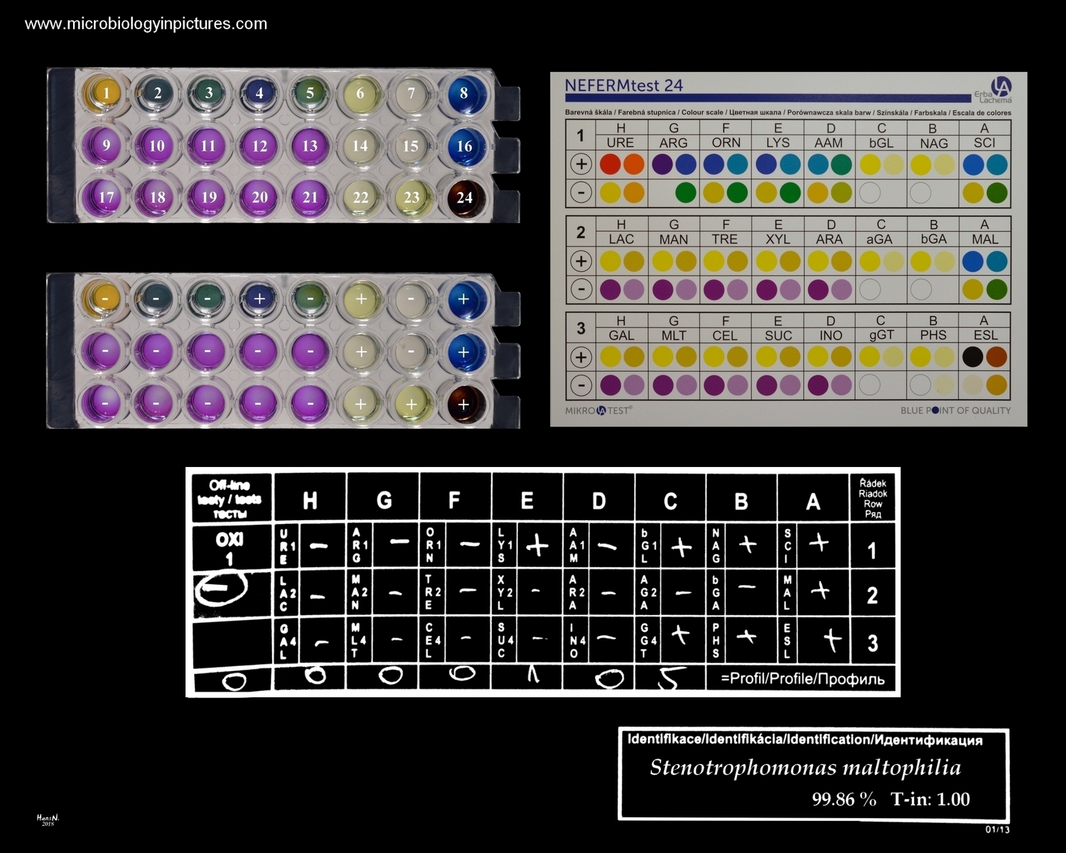 stenotrophomonas maltophilia biochemical identification