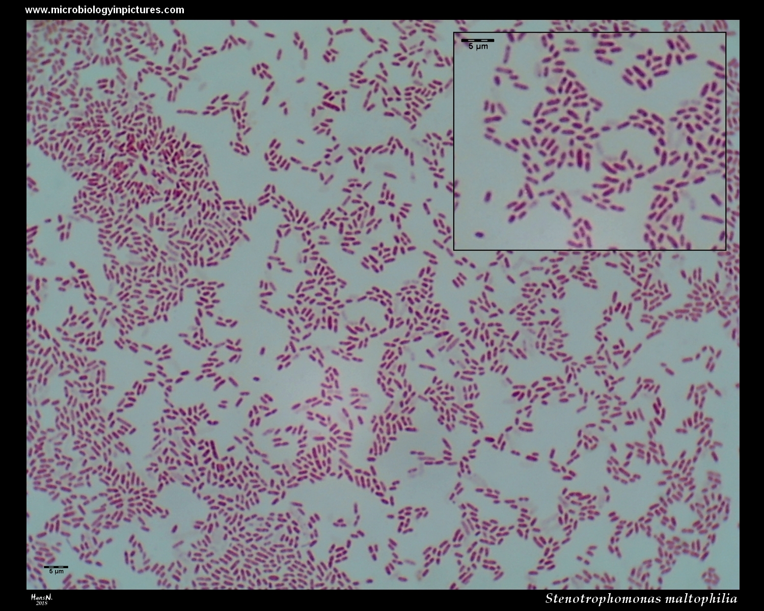 stenotrophomonas maltophilia Gram stain