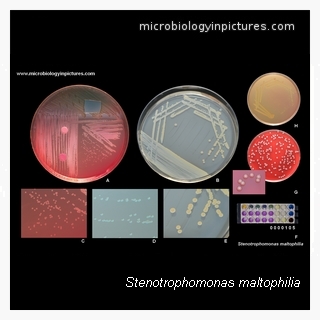 stenotrophomonas maltophilia