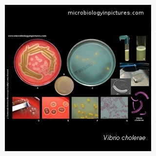 vibrio
