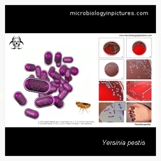 yersinia pestis